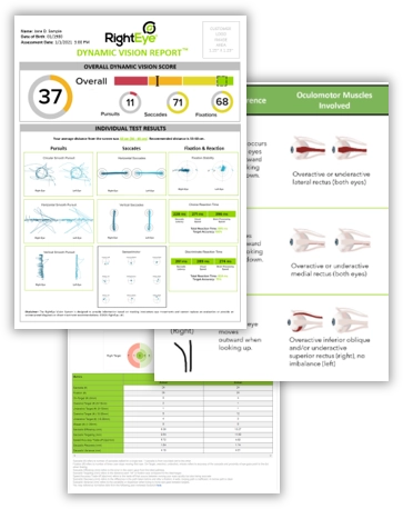 Chiropractic Baton Rouge LA Dynamic Vision Report